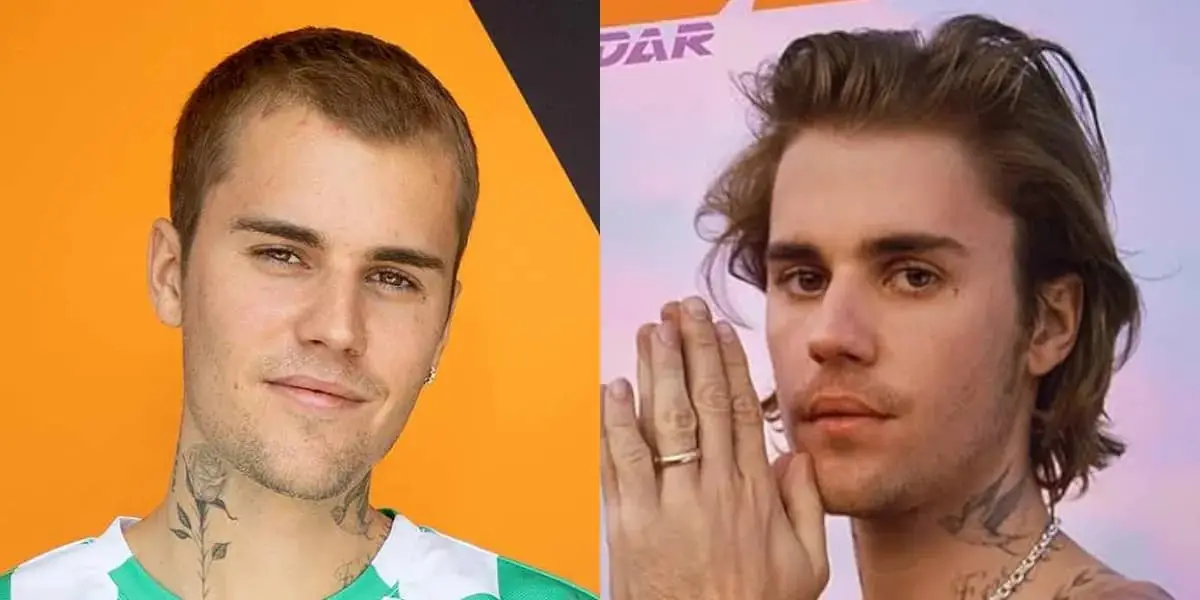 Justin Bieber before — early hairline recession