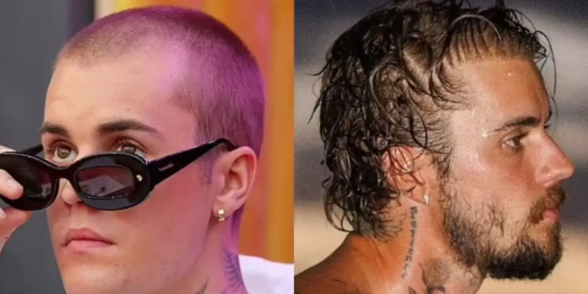 Justin Bieber after — 2024 Grammys hairline