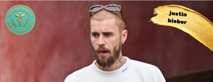 Justin bieber hair transplant analysis