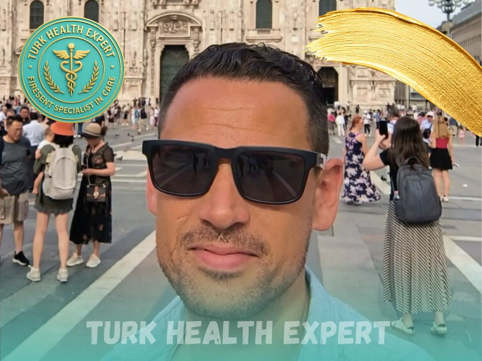 After hair transplant — 14 months, 3,200 grafts DHI, Turk Health Expert Istanbul