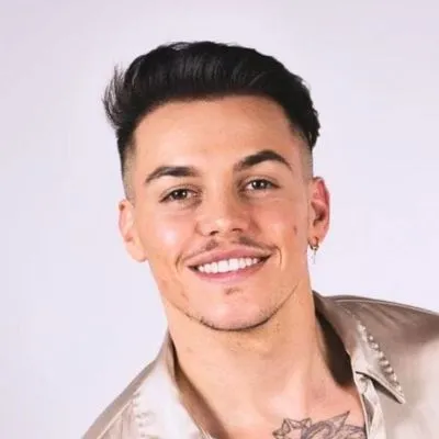 Patient DHI Istanbul résultat 14 mois — Norwood 4, Marseille France